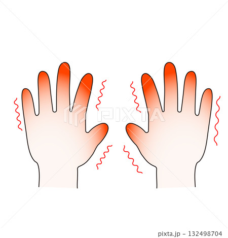 霜焼けのイラスト 霜焼けのイラスト 132498704