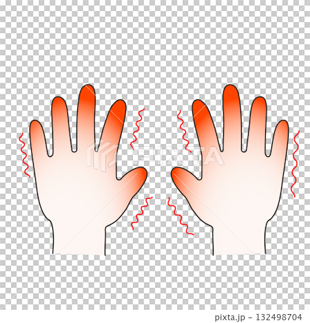 霜焼けのイラスト 霜焼けのイラスト 132498704