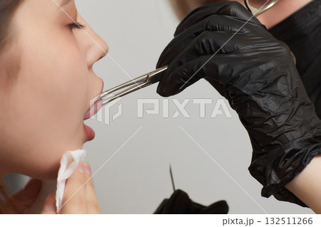 Tongue piercing operation Professional holding the jewel. 132511266