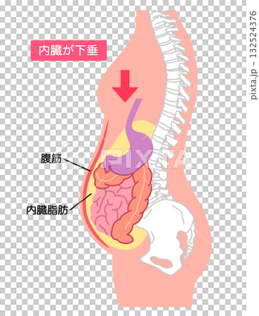 Visceroptosis: A condition in which the internal organs are lowered 132524376