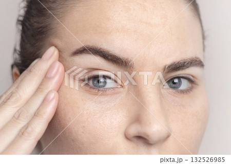 Close-up portrait of Caucasian middle-aged woman pointing to the wrinkles on the upper eyelid. Signs of aging on the face close up 132526985