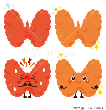 働きが過剰になっている甲状腺のキャラクターと元気な甲状腺のキャラクター 働きが過剰になっている甲状腺のキャラクターと元気な甲状腺のキャラクター 132528071