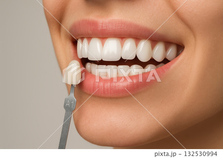 Close up of smile showing white teeth with veneer shade guide held next to teeth for color matching in dental veneer treatment enhancing bright and healthy appearance 132530994