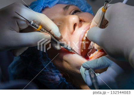 Dentist performs procedure in woman mouth using instruments to gain access and manipulate area. Assistant maintains ensuring vision during treatment.  132544083