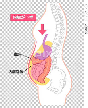 内臓下垂　内臓の位置が下がっている状態 132571707