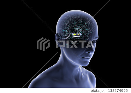 Human brain with degenerated substantia nigra in Parkinson's disease, 3D illustration Human brain with degenerated substantia nigra in Parkinson's disease, 3D illustration 132574996
