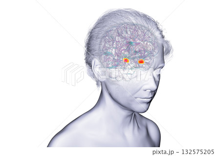 Brain arteries, 3D illustration 132575205