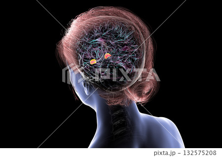 Brain arteries, 3D illustration 132575208