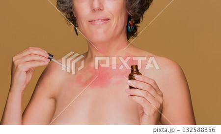 Woman applying serum to sensitive skin with redness 132588356