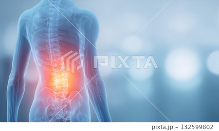 人体モデル - 腰や股関節の痛み（関節炎・腰痛の概念） 132599802