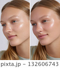 Pigmentation removal progress shown in a clear before-and-after 132606743
