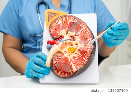 Chronic kidney disease, Asian woman with model for treatment urinary system, urology, Estimated glomerular filtration rate eGFR. Chronic kidney disease, Asian woman with model for treatment urinary system, urology, Estimated glomerular filtration rate eGFR. 132607500