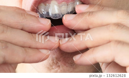 ナイトガードを歯に付ける人物 ナイトガードを歯に付ける人物 132612628