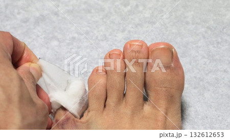 怪我した足のガーゼを取る人物 132612653