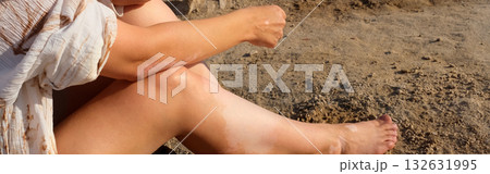 Skin with vitiligo. Female legs and arms with autoimmune disease. pigmentation. banner 132631995