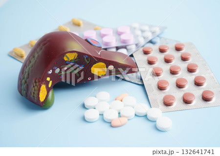 Liver model with pill drug treatment, Cirrhosis, Liver cancer, fatty liver. Liver model with pill drug treatment, Cirrhosis, Liver cancer, fatty liver. 132641741