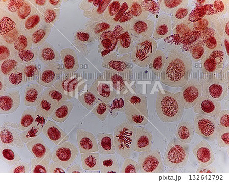 たくさんの細胞を顕微鏡観察 たくさんの細胞を顕微鏡観察 132642792