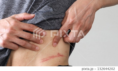 横腹の怪我を指差す人物 132644202