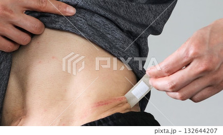 絆創膏を剝がす人物のクローズアップ 132644207