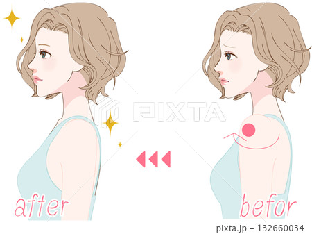 巻き肩を整える女性の横顔ビフォーアフター 132660034