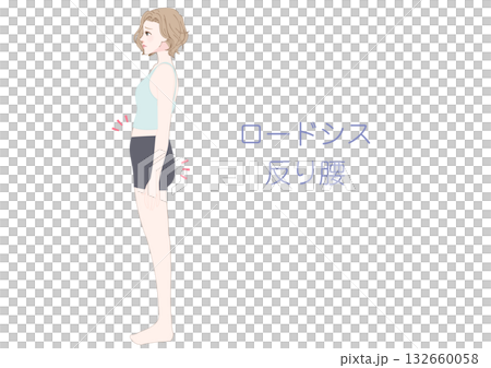 側位插圖,描繪了一位患有脊柱前凸的女性。 側位插圖,描繪了一位患有脊柱前凸的女性。 132660058