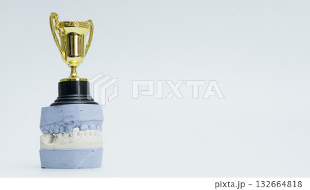 Dental Trophy Displayed on Plaster Cast Model Dental Trophy Displayed on Plaster Cast Model 132664818
