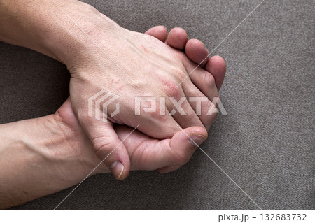 Close-up of male masculine young worker hands with rough skin and short fingernails resting on flat copy space background, top view. Manual labor and hands care concept. 132683732