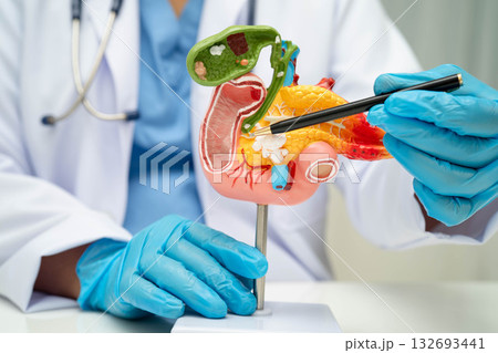 Liver with gallbladder, pancreas spleen and duodenum, Asian doctor holding human anatomy model for study diagnosis and treatment in hospital. Liver with gallbladder, pancreas spleen and duodenum, Asian doctor holding human anatomy model for study diagnosis and treatment in hospital. 132693441