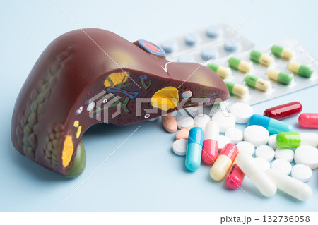 Liver model with pill drug treatment, Cirrhosis, Liver cancer, fatty liver. Liver model with pill drug treatment, Cirrhosis, Liver cancer, fatty liver. 132736058