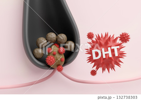 AGAの原因、DHTが毛乳頭を攻撃し薄毛になるメカニズムのCG AGAの原因、DHTが毛乳頭を攻撃し薄毛になるメカニズムのCG 132738303