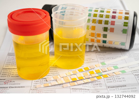 Urinalysis, urine cup with reagent strip pH paper test and comparison chart in laboratory. 132744092