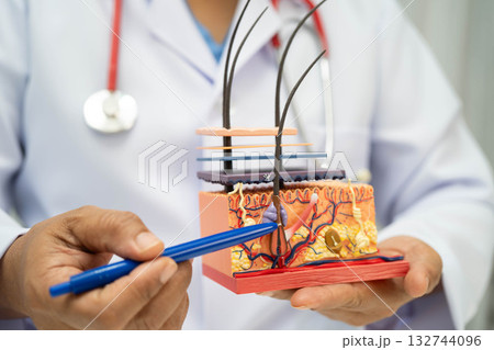 Hair transplant, Asian dermatologist doctor holding skin structure anatomy model for treatment in hospital. Hair transplant, Asian dermatologist doctor holding skin structure anatomy model for treatment in hospital. 132744096