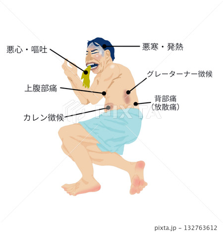全身症状で学ぶ急性膵炎イラスト(男性/医療・看護教材) 全身症状で学ぶ急性膵炎イラスト(男性/医療・看護教材) 132763612