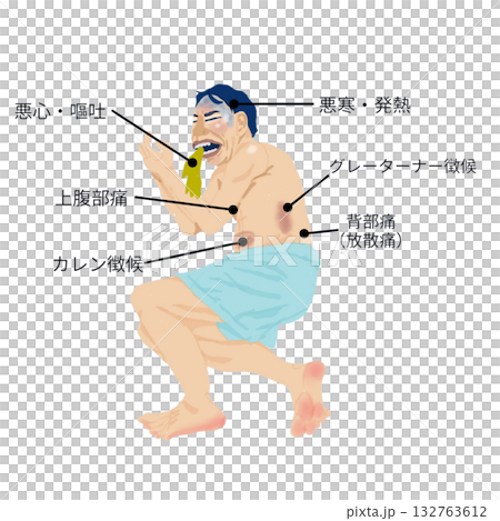 全身症状で学ぶ急性膵炎イラスト(男性/医療・看護教材) 全身症状で学ぶ急性膵炎イラスト(男性/医療・看護教材) 132763612