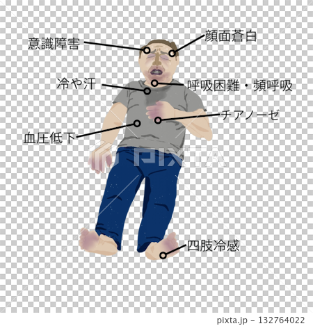 心因性休克症狀圖示（護理和醫學教學材料） 132764022