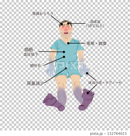 Symptoms of septic shock (nursing and medical teaching materials) 132764023