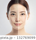 美肌ビフォーアフター 肌改善イメージ 美容効果 132769099