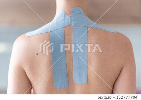 Close-up view of kinesiology tape applied to the neck and shoulder area of a woman. Physical therapy and muscle support through modern rehabilitation techniques 132777704