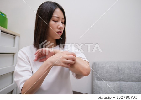 皮膚炎、虫刺され、アレルギーで腕のあたりが痒くなる女性 皮膚炎、虫刺され、アレルギーで腕のあたりが痒くなる女性 132796733