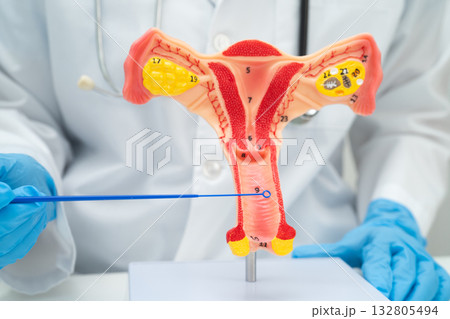 Doctor holding human uterus model for vaginal and cervix pap smear check up in the obstetrics and gynecology. Doctor holding human uterus model for vaginal and cervix pap smear check up in the obstetrics and gynecology. 132805494