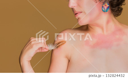 Woman embracing unique beauty despite skin condition 132824432