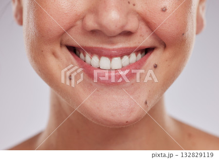 Closeup, teeth and woman with dental care, cosmetics and treatment against grey studio background. Zoom, female and lady with whitening, mouth and oral care with smile, morning routine and grooming 132829119