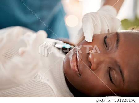 Face, syringe and skincare, black woman at spa with collagen injection for skincare and beauty treatment. Dermatology, cosmetics and person at salon with needle in skin for anti aging facial process. Face, syringe and skincare, black woman at spa with collagen injection for skincare and beauty treatment. Dermatology, cosmetics and person at salon with needle in skin for anti aging facial process. 132829170
