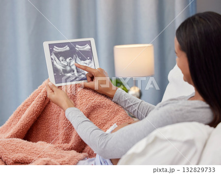 Pregnant, ultrasound scan and mother with tablet in bed with digital x ray of baby, infant and child. Pregnancy love, family home and happy woman excited with prenatal picture on screen in bedroom 132829733