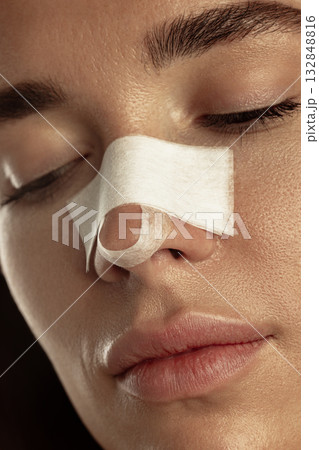 Close up of woman face after nasal correction procedure with bandage on nose resting calmly. Close up of woman face after nasal correction procedure with bandage on nose resting calmly. 132848816