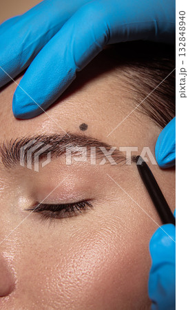 Eyebrow contour marking before correction in aesthetic dermatology procedure. 132848940