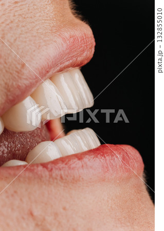 Side view of mature woman smile with white porcelain veneers and natural lips Side view of mature woman smile with white porcelain veneers and natural lips 132855010
