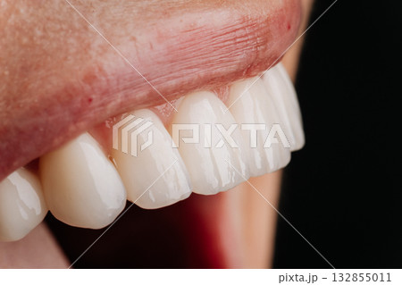 Macro view of clean molars, gums and oral cavity, dental health concept Macro view of clean molars, gums and oral cavity, dental health concept 132855011
