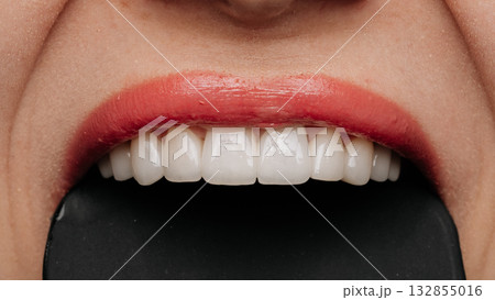 Porcelain veneers smile biting black tool, dental aesthetic macro closeup on black 132855016