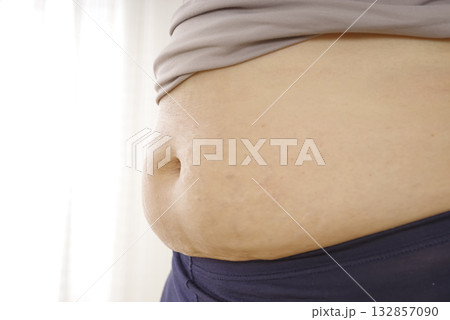 中年女性のぽっこりお腹と皮下脂肪 132857090